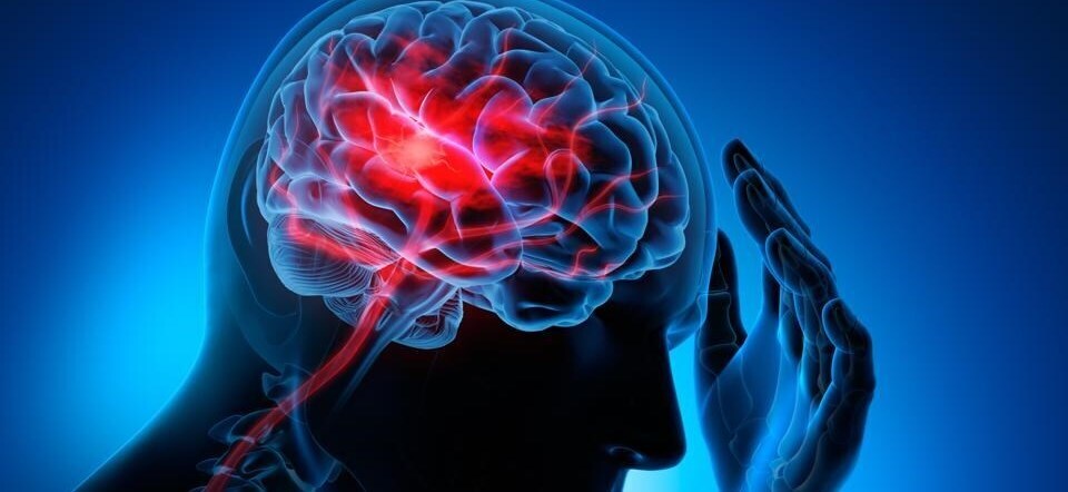 Neurosciences and Stroke